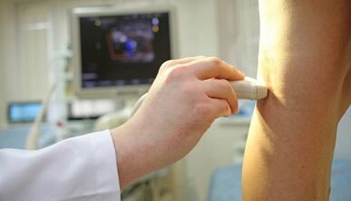Laser treatment of varicose veins