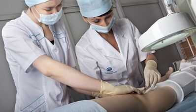 Surgical treatment of varicose veins