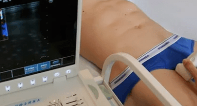 Diagnostic options for varicose veins of the lower ends