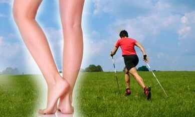 Types of walk allowed for varicose veins